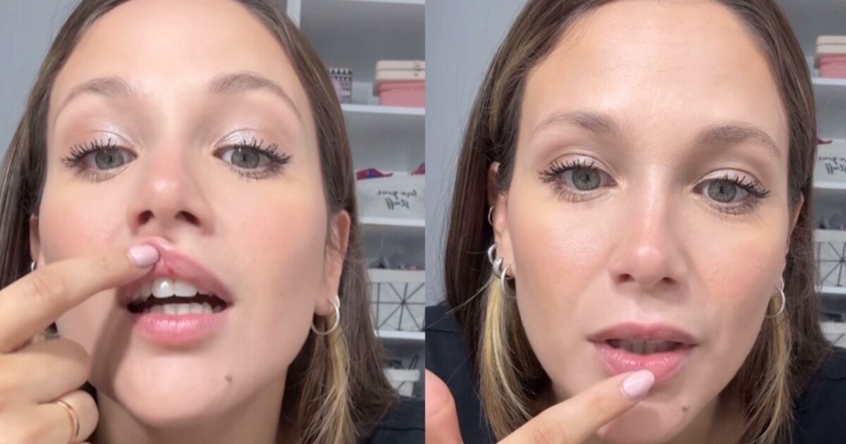 ¡Dolor! Barbie Vélez tuvo un accidente con su hijo Salvador: “Empezó a salir sangre”