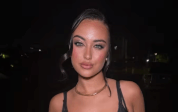 Flor Regidor se hizo una cirugía estética y mostró los sorpresivos resultados