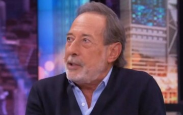 Se accidentó Guillermo Francella y los detalles causaron conmoción: "Se lastimó, pegó su cabeza contra la..."