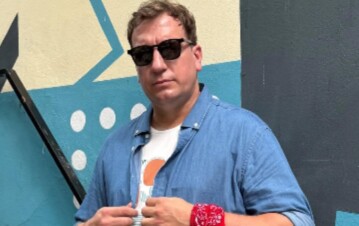 Maxi López se cambió la cara con un retoque estético y dejó a todos en shock: el impactante antes y después