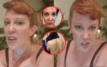 ¡Conmovedor! Miriam Lanzoni confesó que le diagnosticaron psoriasis: "Noches enteras sin dormir envuelta en un film"