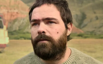 Así quedó Peter Lanzani luego de superar una complicada operacion: la primera foto en la clínica