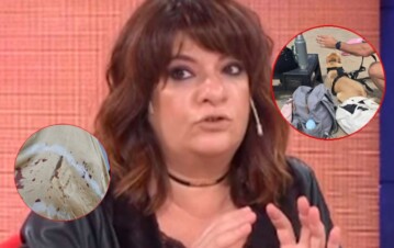 ¡De terror! Andrea Taboada se peleó con una mujer, terminó a las piñas y el perro la atacó: “Tengo la nalga marcada y…”