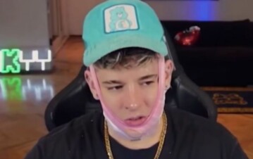 ¡Otra polémica con Oky! Se hizo una lipo en la papada por las críticas que recibía: "Todo fue horrible"