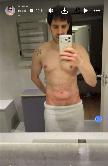 MARTIN CIRIO MOSTRO COMO TENIA EL CUERPO