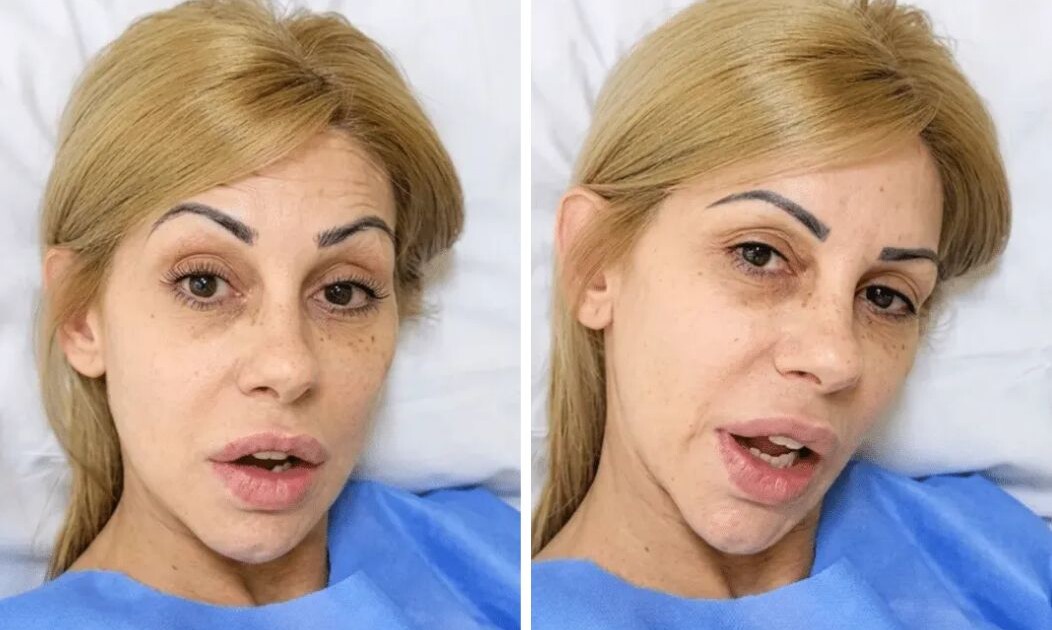 Susto total: qué le pasó a Mónica Farro y por qué terminó en cirugía de urgencia