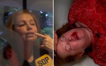 Andrea del Boca dio la cara y destapó si va a volver a Gran Hermano tras su caída: “Tengo los dientes flojos y…”