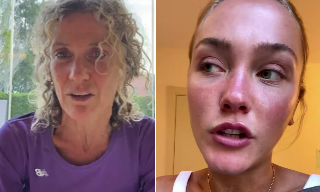 Así de mal quedó la hija de Maru Botana, Sofía Solá, luego de ser atropellada en un confuso episodio