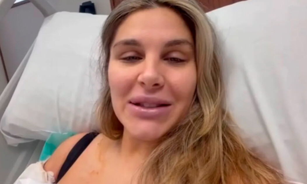 La hermana de Mauro Icardi mostró los terribles resultados de su cirugía estética: “Se me fue de las manos”