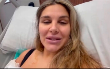 La hermana de Mauro Icardi mostró los terribles resultados de su cirugía estética: “Se me fue de las manos”