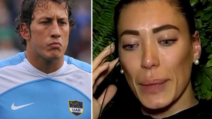 Las estremecedoras fotos de Pamela Pombo con toda la cara golpeada por su ex famoso