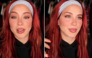 Flor Vigna habló del quiste que le detectaron en la cabeza y lanzó una dolorosa confesión: "Toqué fondo"