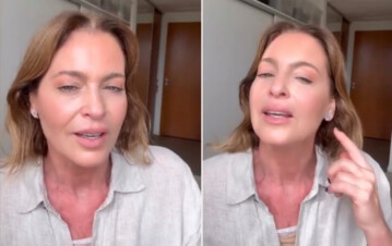 Karina Mazzocco se hizo dos cirugías estéticas y mostró los resultados: “Fue una operación grande”