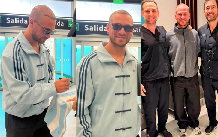 EL "NUEVO" ALEXIS: ASI TIENE LA CABEZA AHORA, Y JUNTO A LOS PROFESIONALES QUE LE HICIERON EL "RESEMBRADO". ¿LE QUEDARA BIEN?