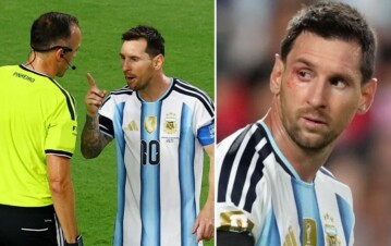 La noche de Messi contra Suiza: de su ojo ensangrentado a su picante discusión con el árbitro