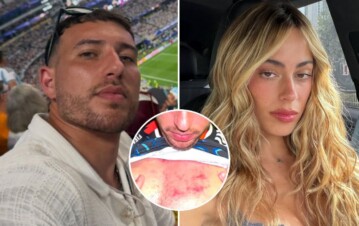 ¡Imágenes sensibles! Así quedó Martín Salwe tras ser agredido al intentar hacerle una nota a Tini Stoessel en el partido de Argentina