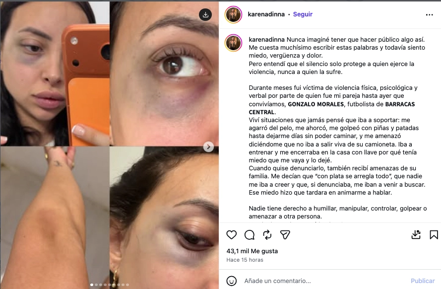 LA TREMENDA DENUNCIA DE KAREN EN SU CUENTA DE INSTAGRAM.
