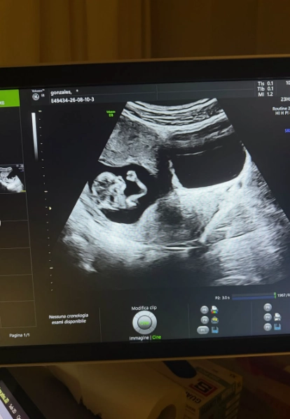 Santi Castro será papá y así lo anunció en redes