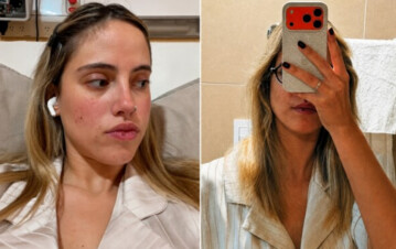El impactante estado de salud de Denisse González en su grave internación: moretones, tratamientos nuevos y mucha incertidumbre