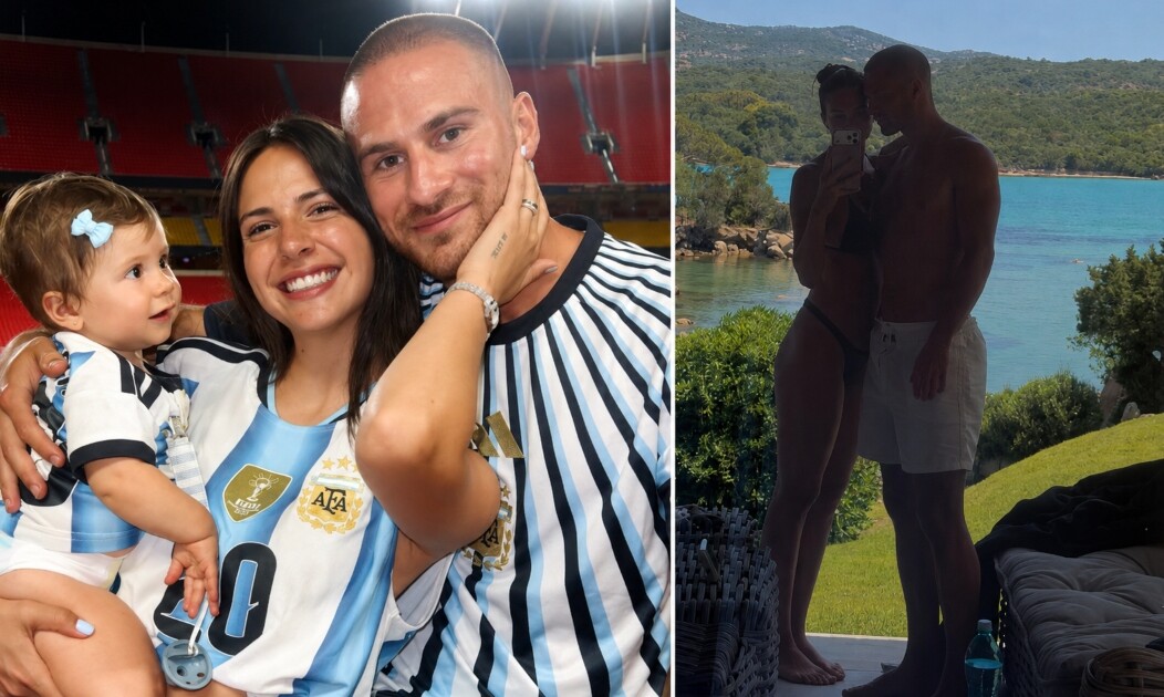 Así quedó Alexis Mac Allister tras someterse a un reimplante capilar: las fotos que mostró Ailén Cova