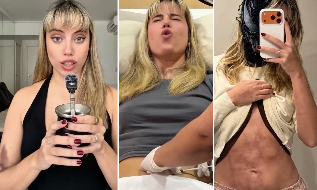 Denisse González habló de su salud y reveló los dolorosos efectos secundarios de su nuevo tratamiento: “Mi cuerpo no controla bien la…”
