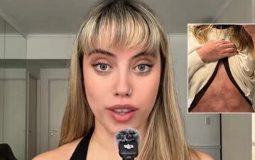 La información de úlitmo momento que dio a conocer Denisse González sobre su salud, con apenas 24 años- Ya no me voy a...