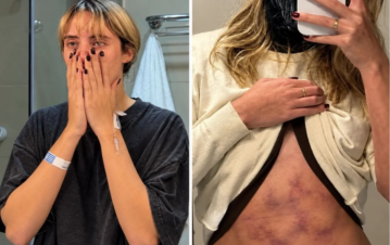 A los 24 años y tras una nueva recaída en su salud, Denisse González habló de su 'estado de riesgo': "Me toca aprender a convivir con esta enfermedad"