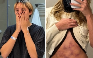 A los 24 años y tras una nueva recaída en su salud, Denisse González habló de su 'estado de riesgo': "Me toca aprender a convivir con esta enfermedad"