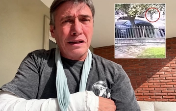 ¡Fuertes imágenes! Tras conocerse el video de Fabián Gianola atropellado por un auto, aparecieron sus fotos con fracturas expuestas: "Se me caía el brazo"